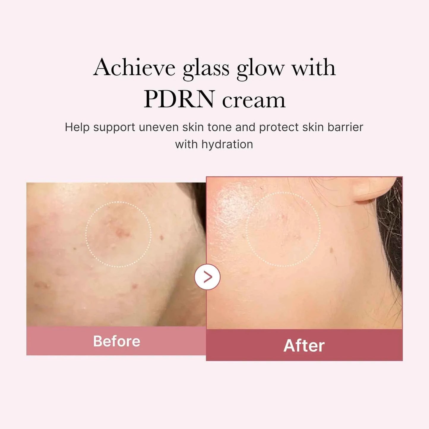 Medicube PDRN Pink Line Skincare Bundle Anti-Aging 5-Piece