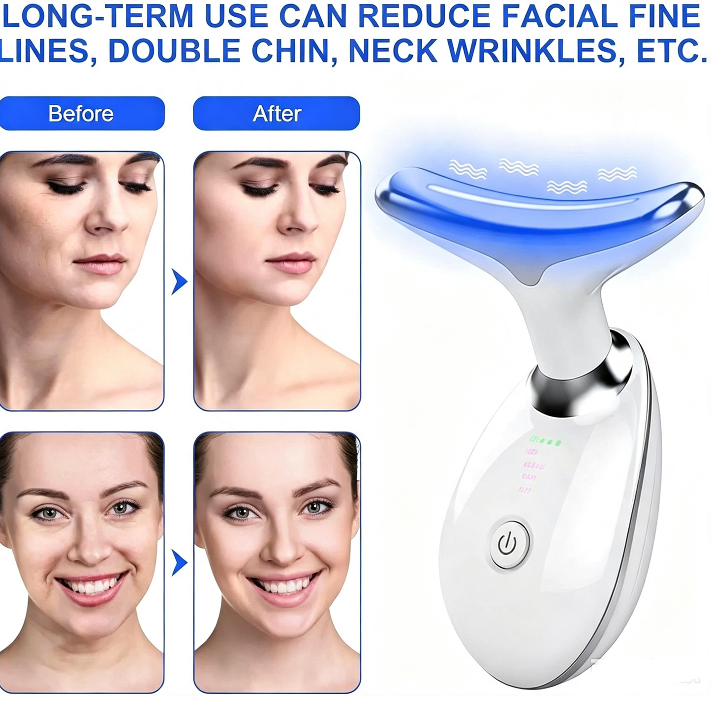 Rejuvenation Face & Neck Massager – LED Skin Care & Beauty Device – White